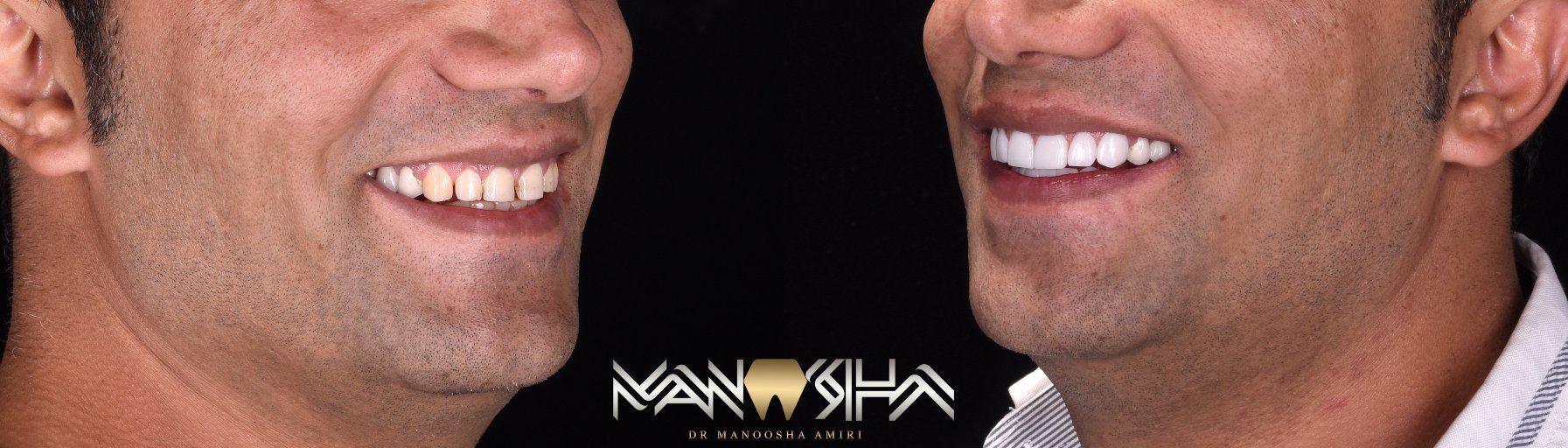 اصلاح طرح لبخند 6 image