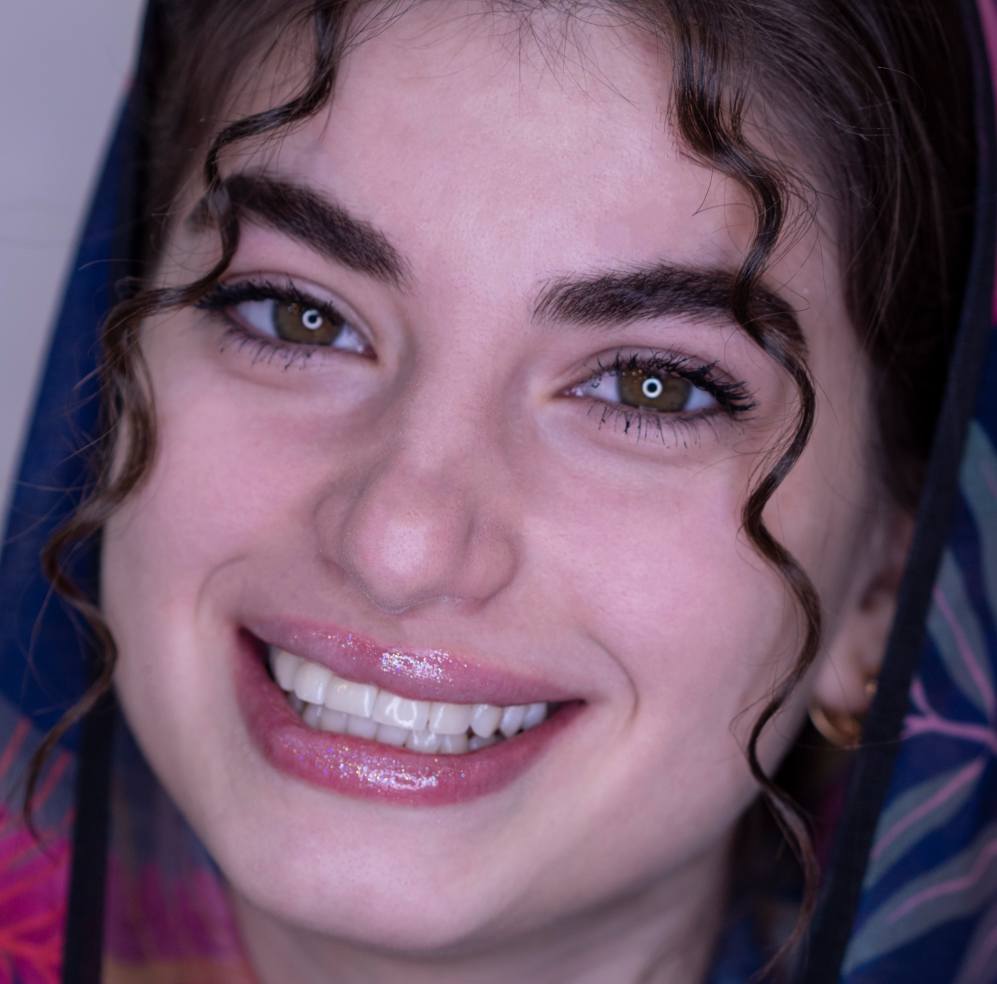 سفید کردن دندان ها 1 image