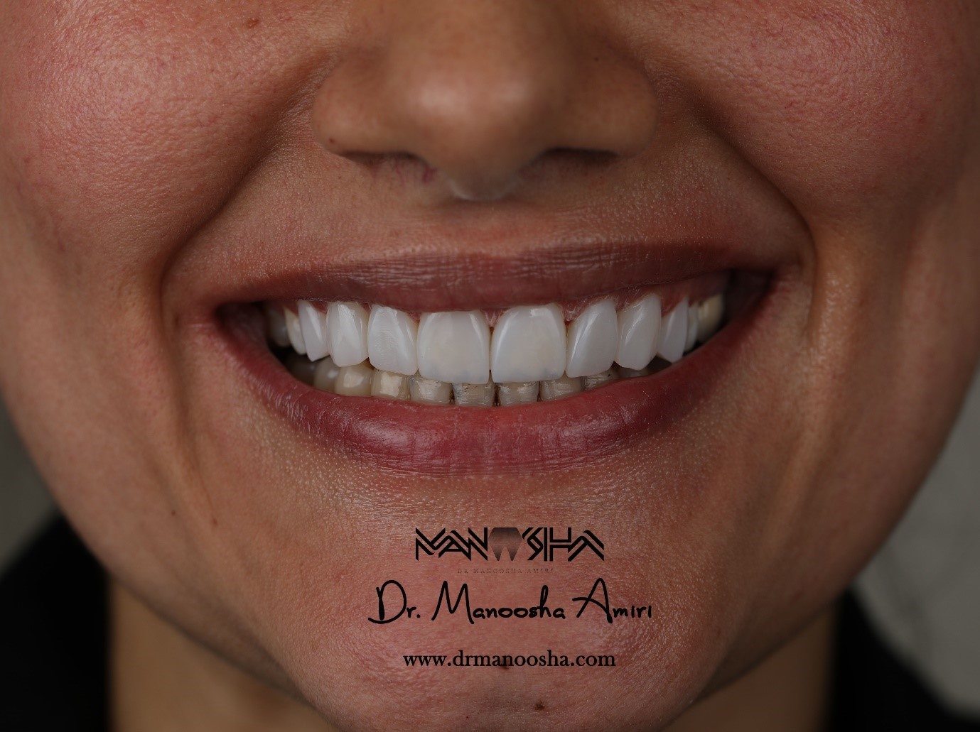 بهداشت دهان