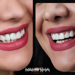دکتر مانوشا امیری متخصص زیبایی دندان در تهران (13)