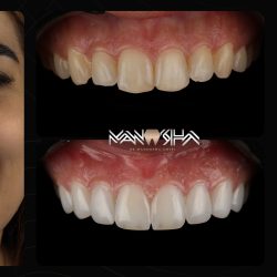 دکتر مانوشا امیری متخصص زیبایی دندان در تهران (4)