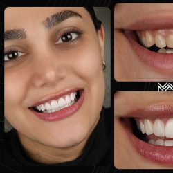 دکتر مانوشا امیری متخصص زیبایی دندان در تهران (5)