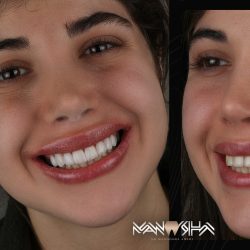 دکتر مانوشا امیری متخصص زیبایی دندان در تهران (8)