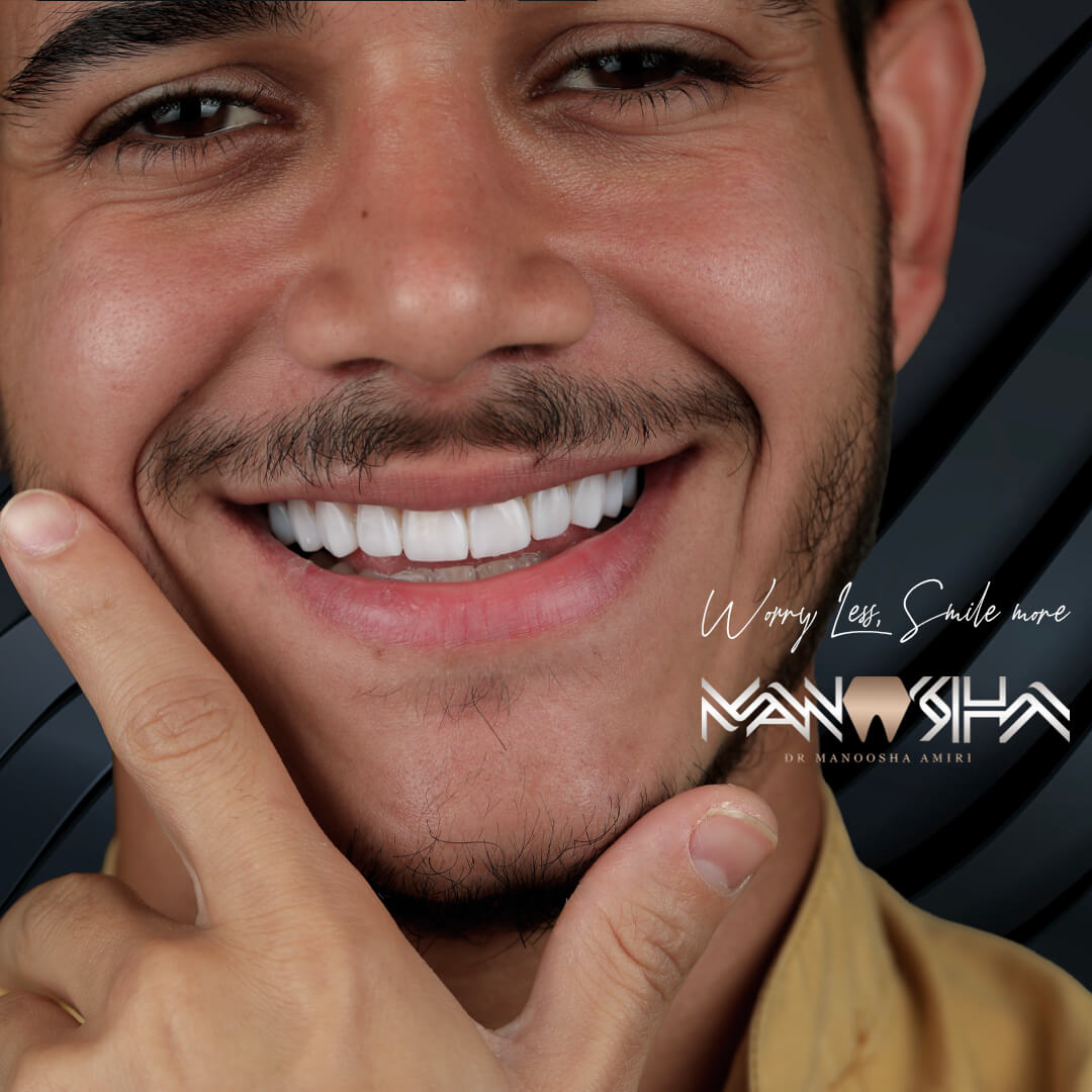 رنگ لمینت دندان